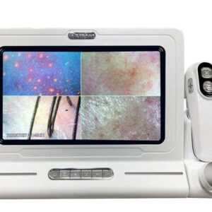 Hair & Scalp Analyzer Microscope Edition M-12 - white